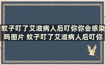 蚊子叮了艾滋病人后叮你你会感染吗图片 蚊子叮了艾滋病人后叮你你会感染吗图片